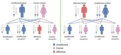 Sex Linked Inheritance Concise Medical Knowledge