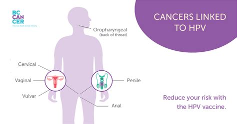 Infographic Explanation Of Pap And Hpv Tests For Cervical 41 Off