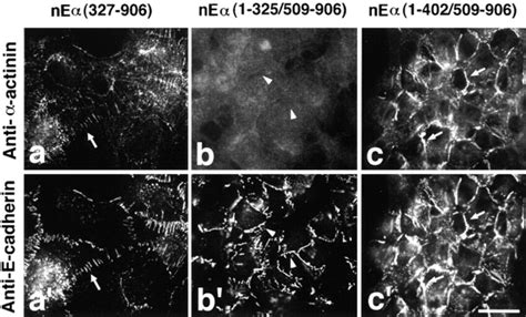 Subcellular Localization Of Actinin And E Cadherin Catenin Fusion