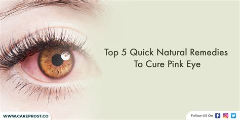 Top 5 Quick Natural Remedies To Cure Pink Eye