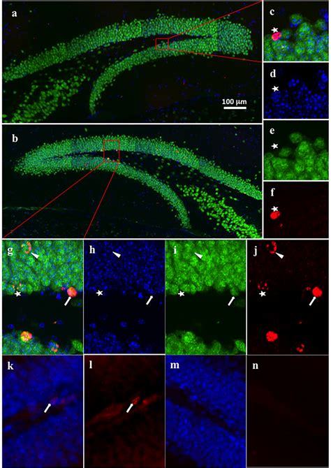 Representative Images Of Brdu Incorporation Within Mature Neurons In