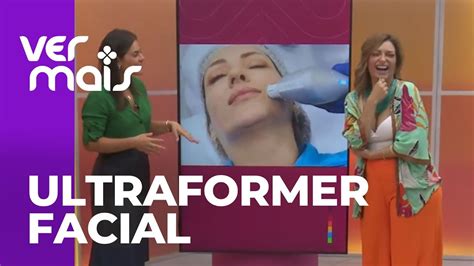 Ultraformer Facial Reduz O Col Geno E Ajuda Na Flacidez Youtube