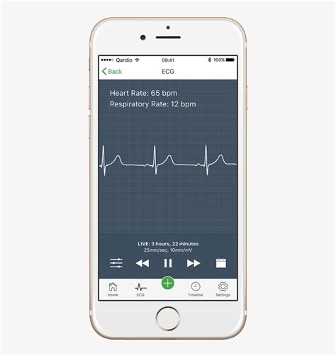 Download Transparent How To Read An Electrocardiogram - Afib Heart Rate Monitor - PNGkit