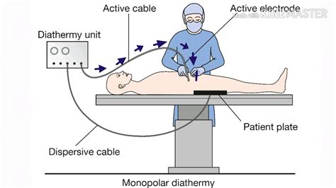 How To Use Diathermy Machine