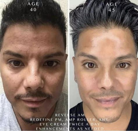 Talk About A Transformation Aging Backwards Look At These Results