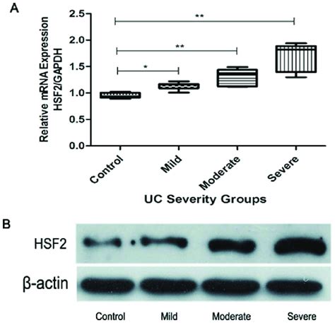 Expression Of HSF2 In Colonic Mucosa Tissues Of UC Was Examined By