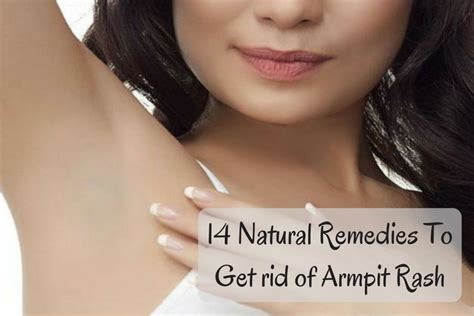 14 Natural Remedies To Get Rid Of Armpit Rash Wellness Guide