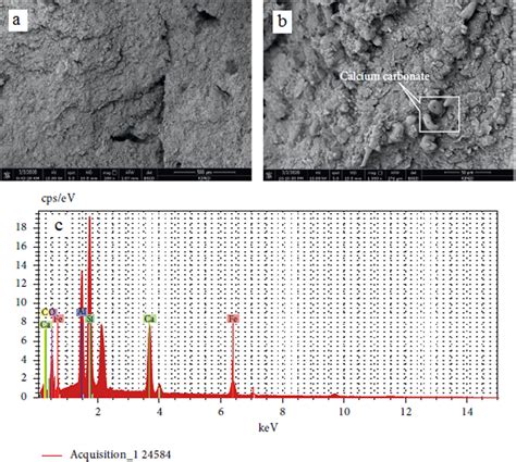 The Significance Of Scanning Electron Microscopy Sem Analysis On The