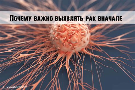 Мнение врачей онкологов по причинам возникновения рака