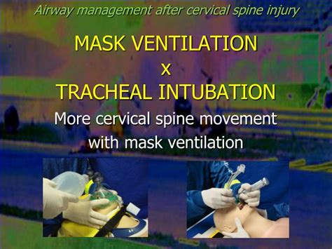 Ppt Airway Management After Cervical Spine Injury Powerpoint