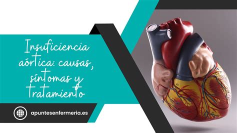 Anemia drepanocítica causas síntomas diagnóstico y tratamiento