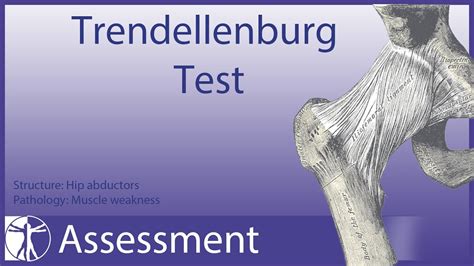 Trendelenburg Test Hip Abductor Weakness Youtube