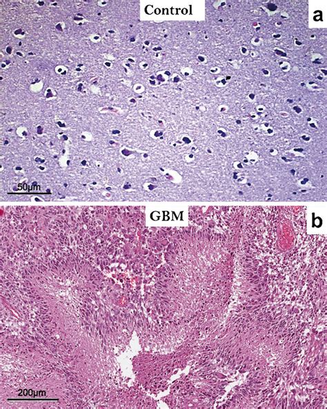 Histological Findings A Representative Hematoxylin Eosin