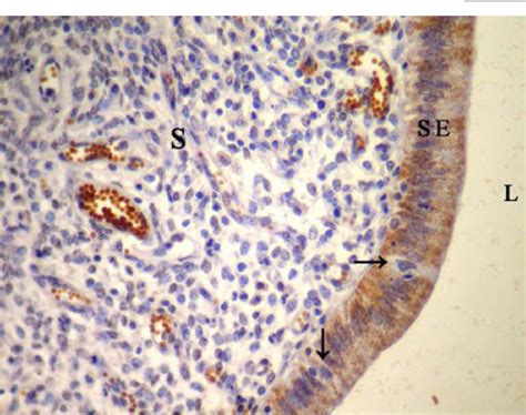 Figure 1 From Immunohistochemical Detection Of Estrogen And Progesteron