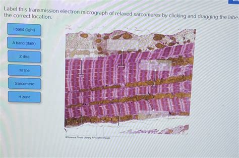 Label This Transmission Electron Micrograph Of Relaxed Sarcomeres By