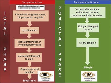 Pupillary Hippus As Clinical Manifestation Of Refractory Autonomic