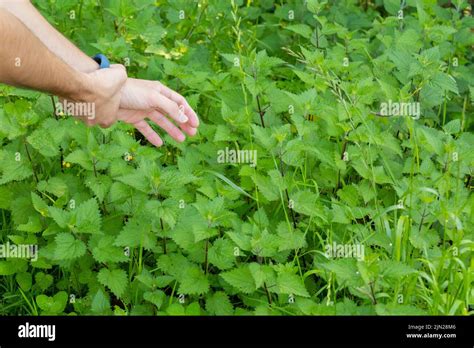 sore hand  touching nettles  stinging nettles stock photo alamy