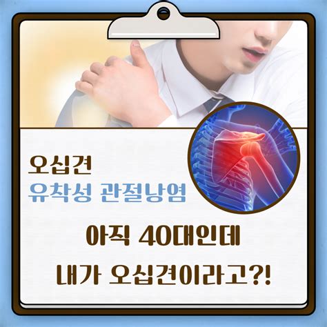 오십견 치료 방법 단계 운동 스트레칭 원인 증상 Physical Therapy Guide