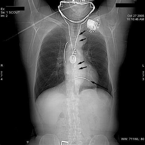 Mastermedfacts Chest X Ray