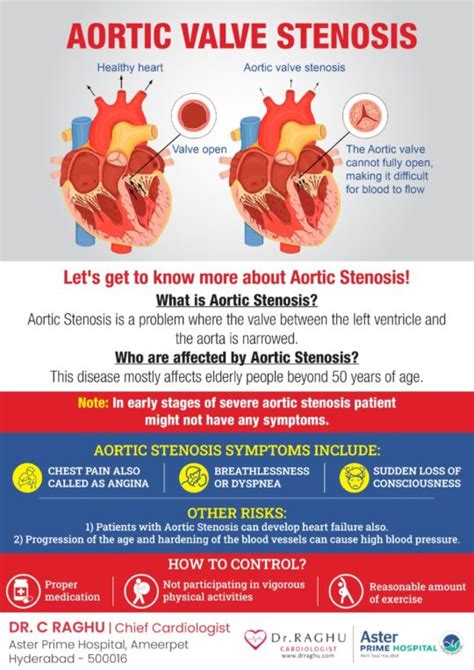 What Are Aortic Stenosis Symptoms And Causes Dr C Raghu