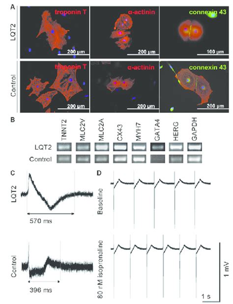 Cardiomyocyte Differentiation Service From Ipsc Creative Bioarray