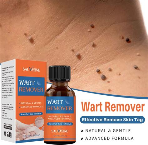 Buy Wart Remover10ml Painlessly Removes Plantargenital Wartsnatural