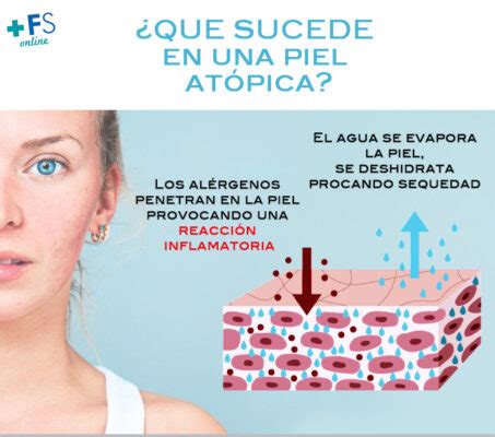 qué significa atópico CONADEIP