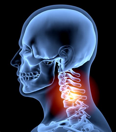 Restore Mobility Today With A Whiplash Chiropractor That Treats Auto