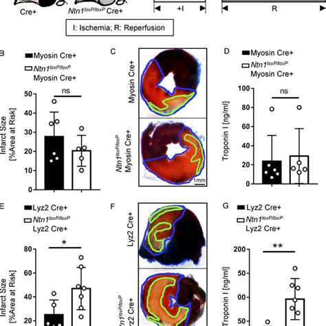 Ntn Loxp Loxp Lyz Cre Mice Have Severe Injury After Myocardial Ir