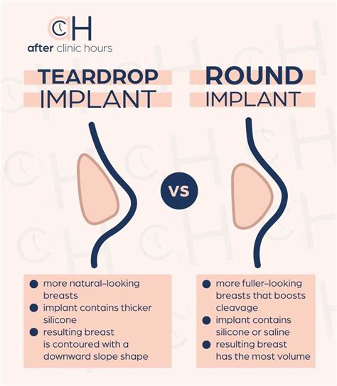 Pinterest Implants Breast Breast Implants Sizes Breast Augmentation