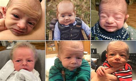 These Old Looking Babies Are Real Life Benjamin Buttons Daily Mail Online