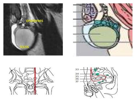 Scrotal Ultrasound Ppt