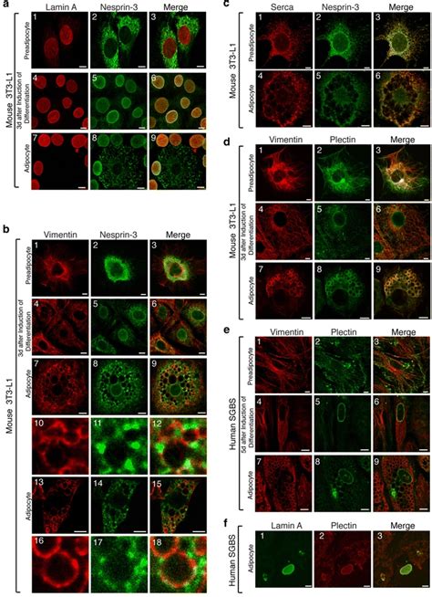 Reorganization Of The Nuclear Cytoskeleton Junction During