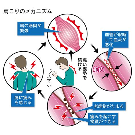 肩こりの6つの要因について解説！ 骨盤矯正・産後骨盤矯正専門ボディケアサロン│骨盤labo