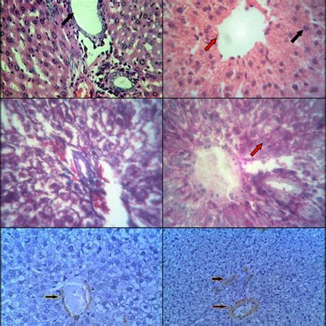 A A Photomicrograph Of The Control Liver Of Adult Albino Rat Showing Download Scientific