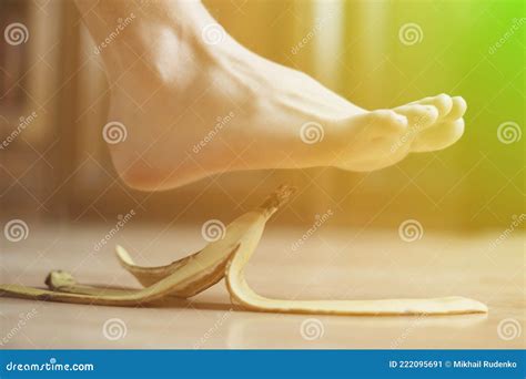 Leg Slip On Banana Peel And Have An Accident B Stock Image Image Of