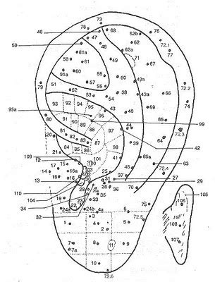 Acupuntura Y Homeopat A Odontol Gica Webdental Cl Portal