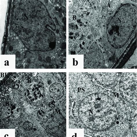 A And B Electron Micrographs Of Portions Of Seminiferous Tubules Of