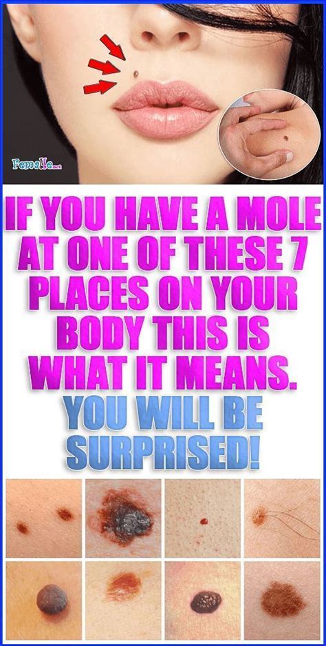 If You Have A Mole At One Of These 7 Places On Your Body This Is What It Means How To Stay