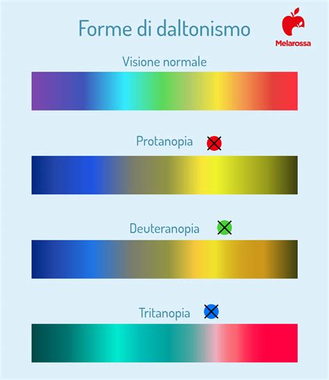 Daltonismo cosè le diverse forme cause diagnosi e trattamento