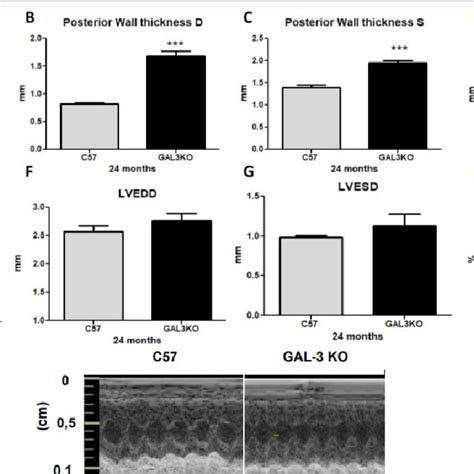 A Cardiac Mass Index As Calculated By Echocardiography In Aged C57 And