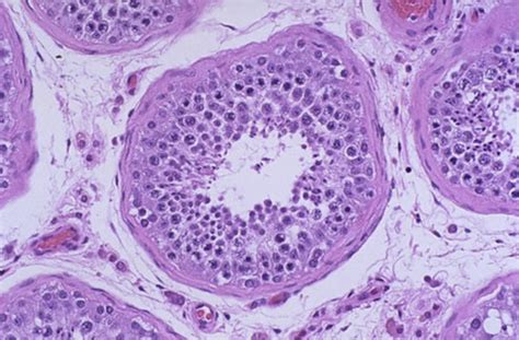 Male Repro Histology Flashcards Quizlet