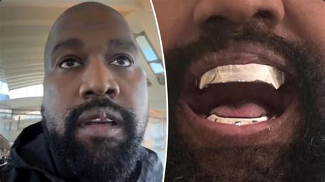 What Happened To Kanye Wests Lips Protruding Growth Sparks Concerns