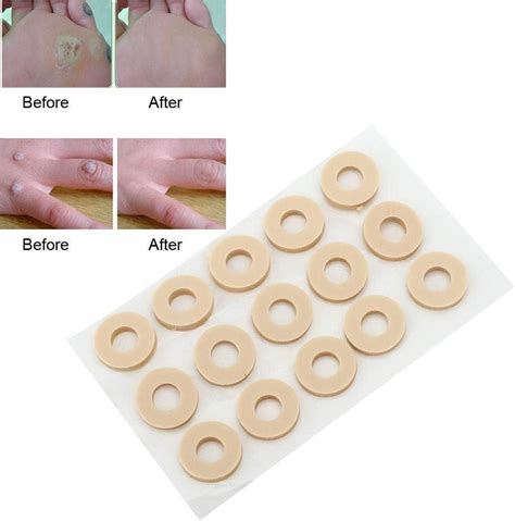 15Pcs Corn Removal Callus Patch for Foot Care - Easy Corn and Callus Removal