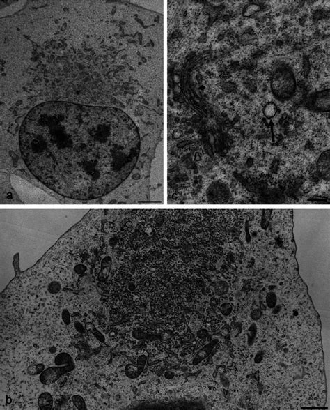 Ultrastructural Changes In Cells At Early Stages Of Infection With