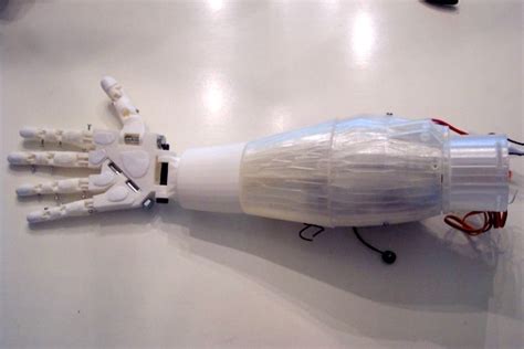 Arduino-controlled prosthetic hand operates on verbal commands ...