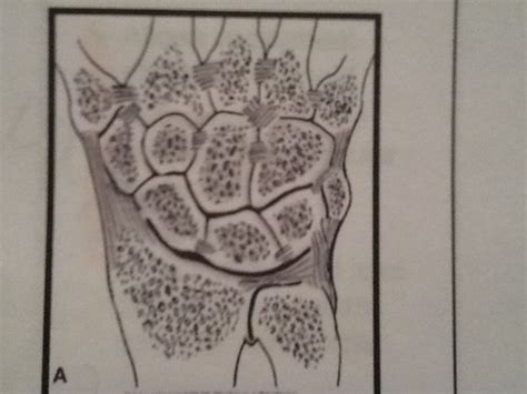 Unit 1 General Bones Projections Positions Body Habitus Flashcards