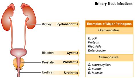 E Coli Pyelonephritis Antibiotics