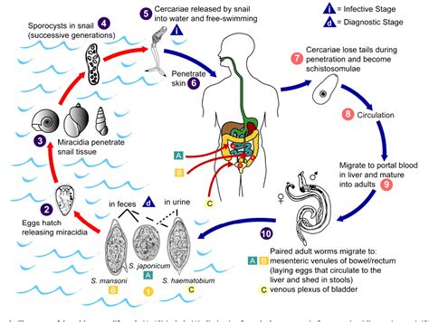 Figure 1 From Atypical Presentation Of Cerebral Schistosomiasis Four Years After Exposure To