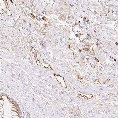 LYVE1 Antibody (PA5-111168)